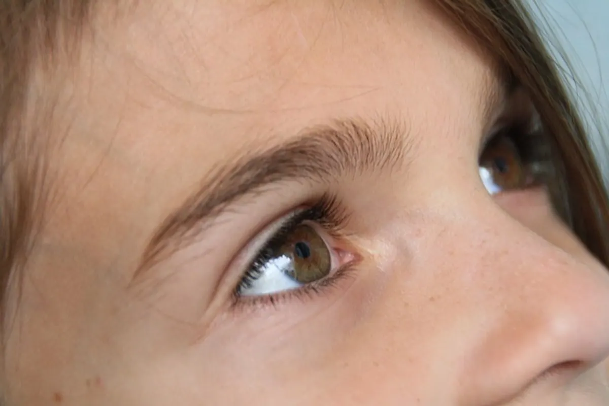 Lentille de contact souple posée dans un étui propre avec une solution d’entretien.